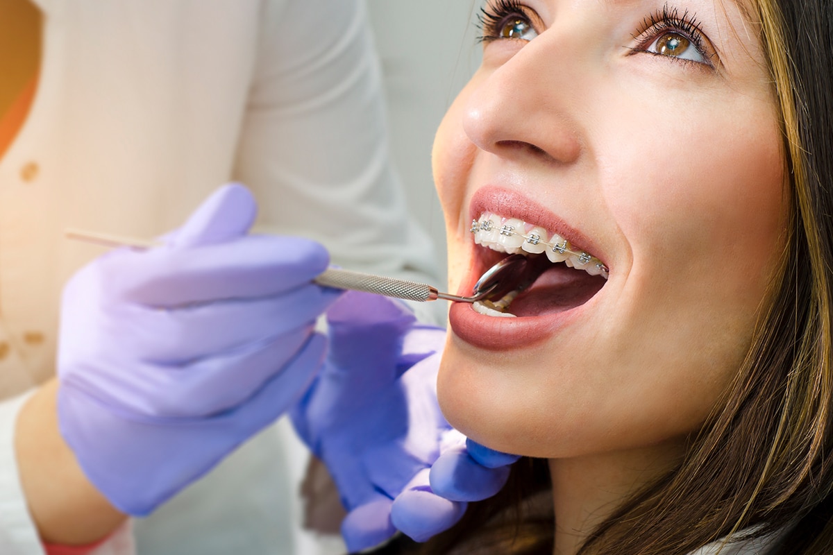 How orthodontics can improve jaw alignment blog