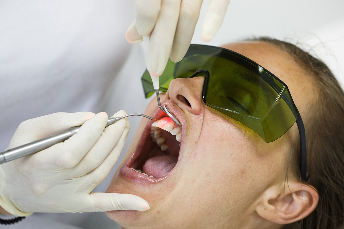 Laser Teeth Whitening How It Works And What To Expect Blog