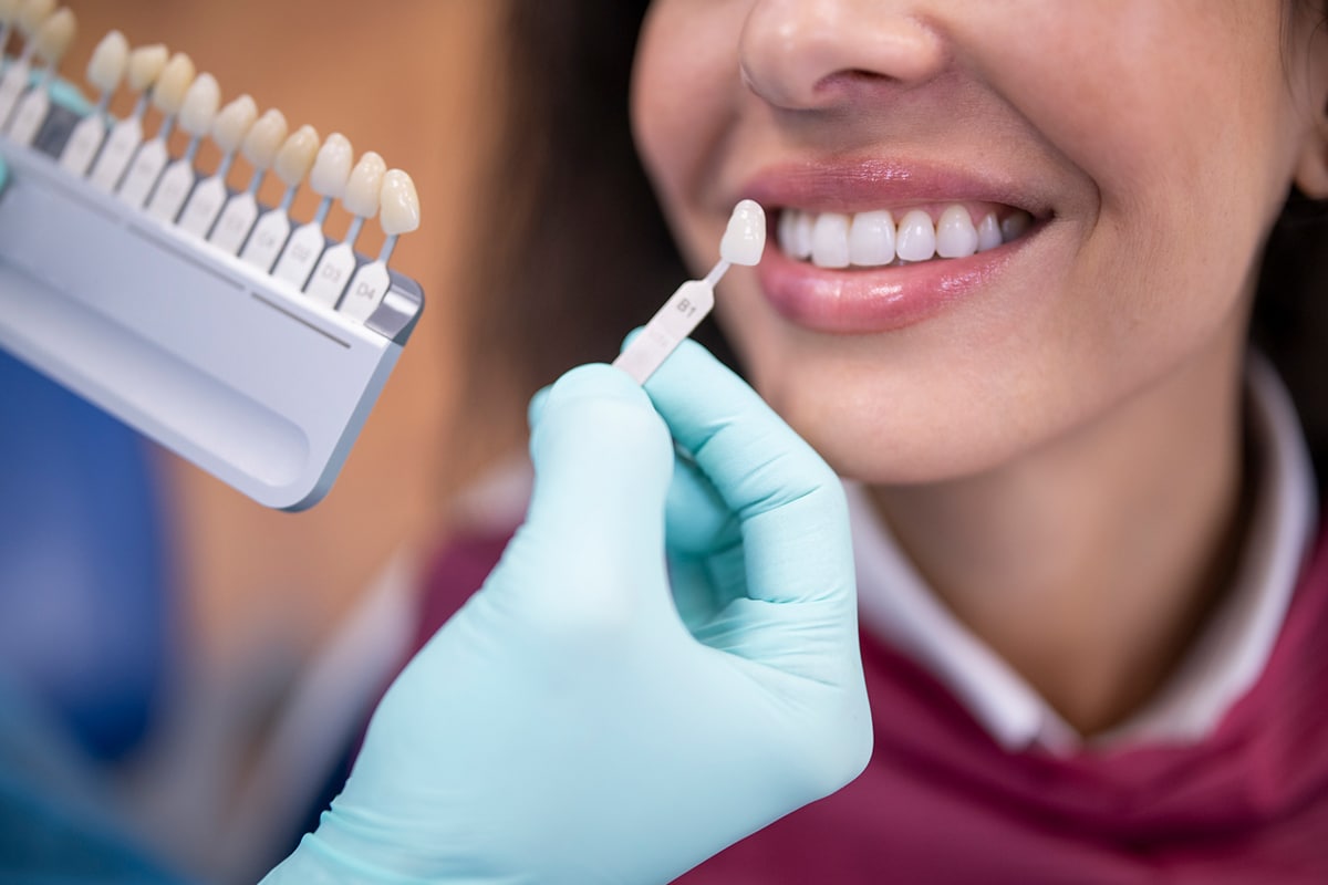 Porcelain Veneers Are They The Right Choice For You Blog